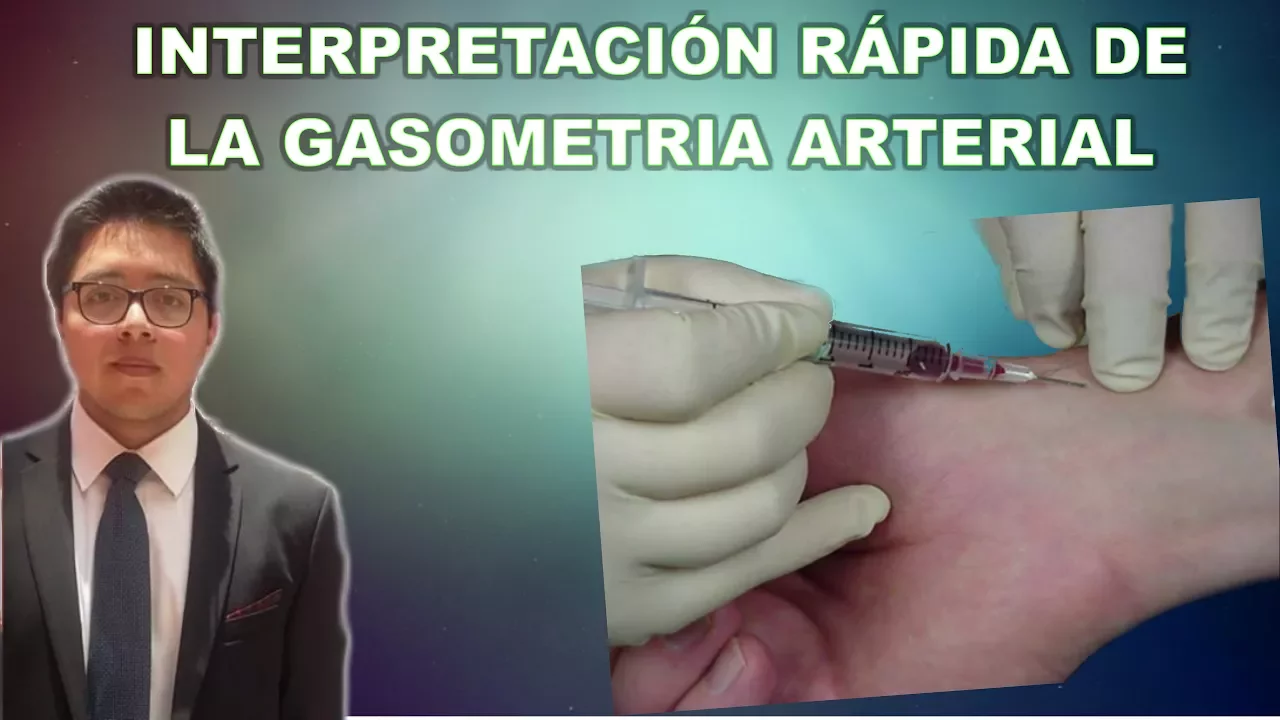 Interpretación rápida de la gasometría. Ivan Ríos
