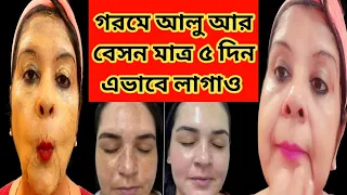 গরমে বেসন আর আলুর ম্যাজিক।। মাত্র ৫ দিনে নতুন ঝকঝকে ত্বক পাও।। ফর্সা হওয়ার সহজ উপায়।Fairness Facial