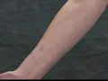 How to apply 3M Cavilon Durable Barrier Cream