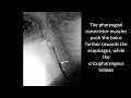 Swallowing disorders - Normal swallowing