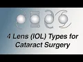 Download Lagu 4 Main Lens (IOL) Types for Cataract Surgery: Pros and Cons (Basic Version)