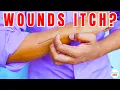 Why Do Healing Wounds Itch