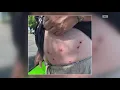Protestors recount BB gun shootings at Auburn No Kings rally