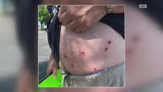 Protestors recount BB gun shootings at Auburn No Kings rally