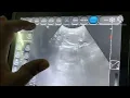 how vet diagnosis the fetal age of pregnant dog to know the exact time of delivery with ultrasound