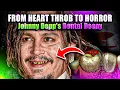 Johnny Depp s Teeth Controversy A Detailed Breakdown