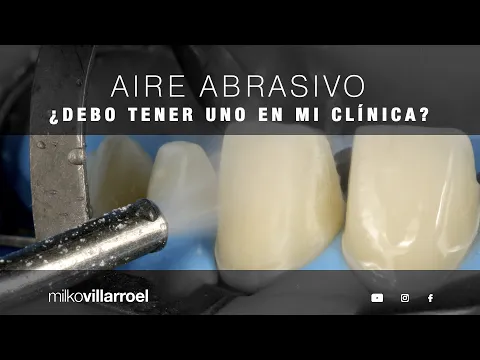 Download MP3 Aire abrasivo, un excelente complemento para procedimientos adhesivos | Milko Villarroel