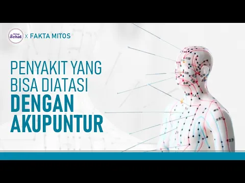 Akupuntur Bisa Atasi Penyakit Apa Saja? Cek Disini