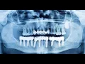 Orthopantogram CPT code - simplify medical coding