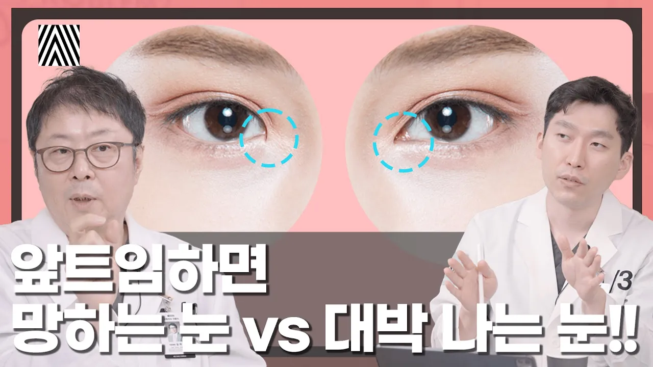이런 분들은 앞트임하면 안됩니다!! 앞트임, 윗트임에 대한 모든 것!! 앞, 윗트임 1편_[4월31일 성형외과]