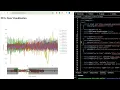 EEG Data Visualization with Flask Plotly Real-Time Analysis Ethics and Seizure Detection
