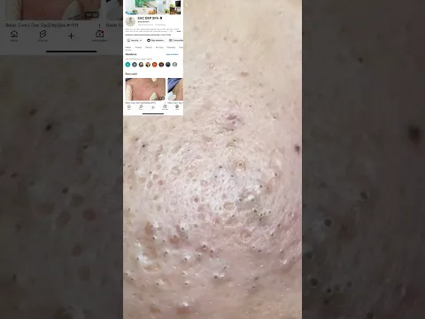 Tirando labafero da cara dos clientes #unhas #videosatisfatorio #viral