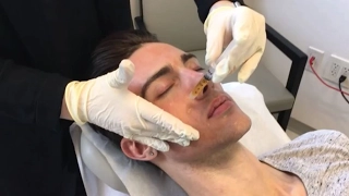 vampire facial review by travis bryant