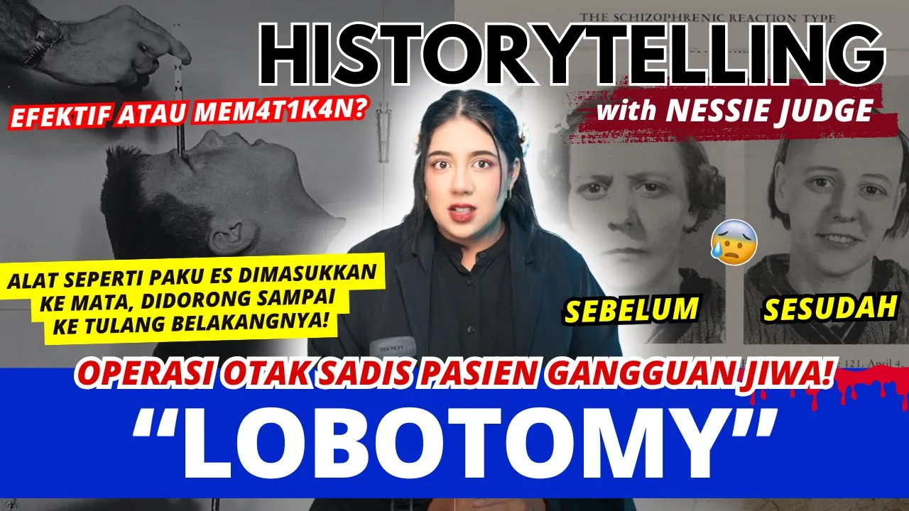 "LOBOTOMI" Operasi Otak TERKEJAM dalam SEJARAH! | #HISTORYTELLING