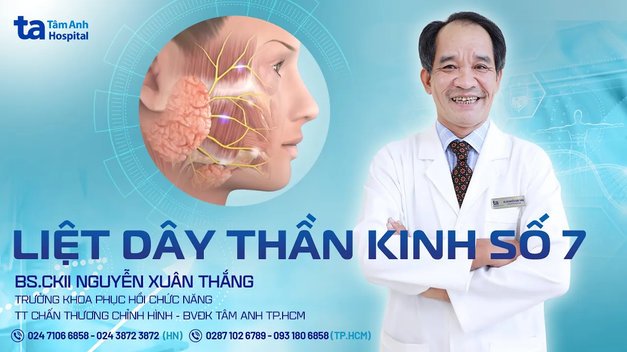 Outline Video Liệt dây thần kinh số 7: Nguyên nhân, dấu hiệu, điều trị | BS.CKII Nguyễn Xuân Thắng | CTCH Tâm Anh