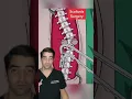 Download Lagu Scoliosis Surgery