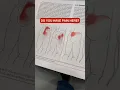Repair and Relieve Glute Pain Forever with this Easy Mobility Exercise