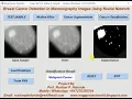 Matlab Code for Breast Cancer Detection Using Neural Network IEEE Based Project