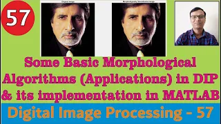 Some Basic Morphological Algorithms Applications in DIP and its implementation in MATLAB Image