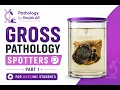 Gross Pathology Spotter Part 1 2026 For MBBS MD