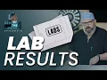 Pre-op Understanding Your Lab Results