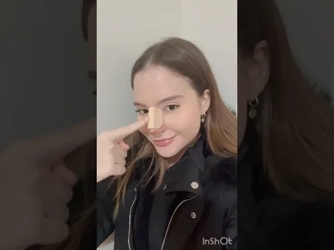 Sophia Valverde faz plástica no nariz, veja o antes e depois