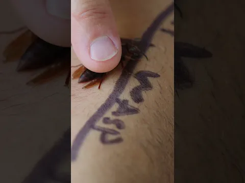 Bitten AND stung at the same time!