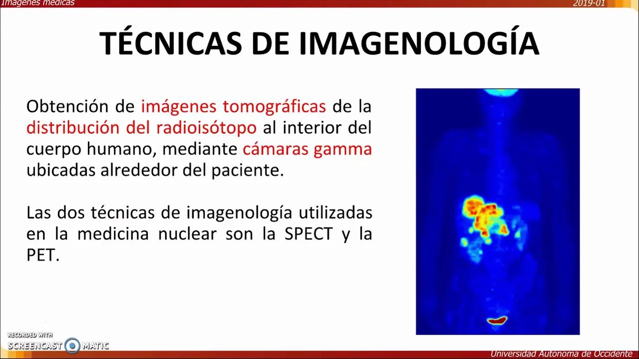 MEDICINA NUCLEAR: SPECT & PET