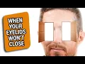 What Happens When Your Eyelids Won’t Close? | Knock Knock Eye