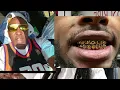 Permanent Gold Teeth Mississippi Gold