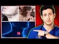3 Diseases Doctors Often Miss PCOS EDS Thyroid Disorders