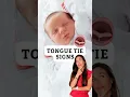 Lagu Could Your Baby Have a Tongue Tie? Key Signs to Know!
