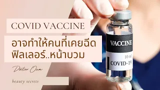 อุบัติการณ์ที่ฟิลเลอร์บวมขึ้นหลังฉีดวัคซีนโมเดิร์นนาเป็นเท่าไหร่