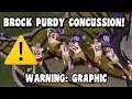 Brock Purdy CONCUSSION INJURY Vs Vikings 49ers Vs Vikings 2023 highlights