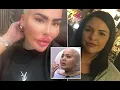 Bizarre life of surgery obsessed Lip King linked to Alice Webb BBL death and what he looked like