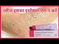 Download Lagu Derobin Cream Uses In Hindi | What is the purpose of Derobin Cream? Derobin Ointment derobin