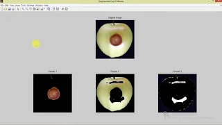 Matlab Code for Fruit Disease Detection and Classification Using Image Processing