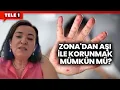 Download Lagu Zona'nın belirtileri nedir, tedavisi nasıl olur? | SAĞLIK GÜNDEMİ (17 AĞUSTOS 2024)