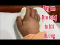 Download Lagu Tay e Dậu sưng to bất thường.A Thành 0000 bị giang hồ đe doạ#thichminhtue #doanvanbau