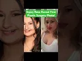Gypsy Rose First Nose Job Pics Revealed