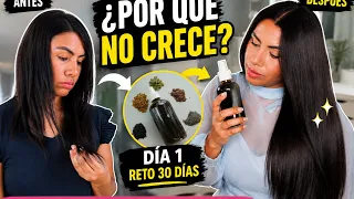 Crece tu cabello con esto… Hoy empieza mi reto de 30 días 🌱