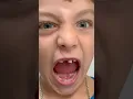 Oliver and Lucas Pull a Loose Tooth Losing a Baby Tooth