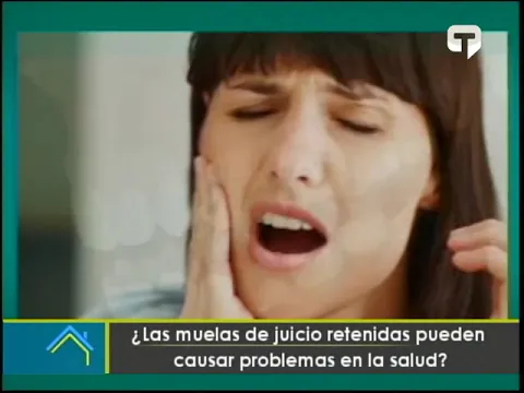 Las muelas de juicio retenidas pueden causar problemas en la salud