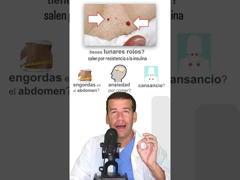 Hazte el diagnóstico en casa