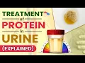 Lagu Behandeling van eiwitten in urine (uitgelegd)