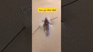 طريقه خياطه جرح صغير جرح خياطة جراحة التجميل غرزة تمريض طبيب Sutures  طريقه خياطه جرح صغير جرح خياطة جراحة التجميل غرزة تمريض طبيب Sutures