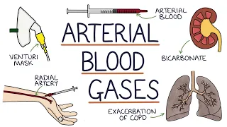 Download Understanding Arterial Blood Gases MP3