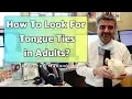 Lagu How To Look For Tongue Ties In Adults