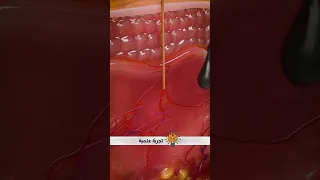 كيف يعيش القمل في رأسك 