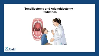 Tonsillectomy and Adenoidectomy - Pediatrics
